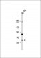 Methionyl tRNA Synthetase Antibody (C-term)